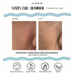 Vacation Skin Redness Recovery Overnight Mask and Moisturizer